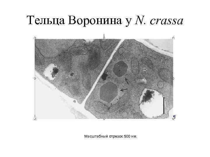 Тельца Воронина у N. crassa Масштабный отрезок 500 нм. 