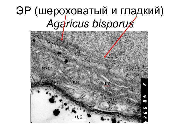 ЭР (шероховатый и гладкий) Agaricus bisporus 