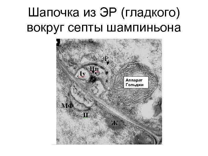 Шапочка из ЭР (гладкого) вокруг септы шампиньона Аппарат Гольджи 