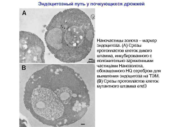 Эндоцитозный путь у почкующихся дрожжей Наночастицы золота – маркер эндоцитоза. (A) Срезы протопластов клеток