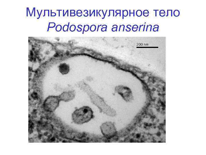 Мультивезикулярное тело Podospora anserina 