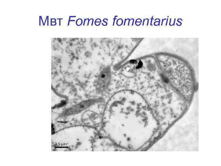 Мвт Fomes fomentarius 