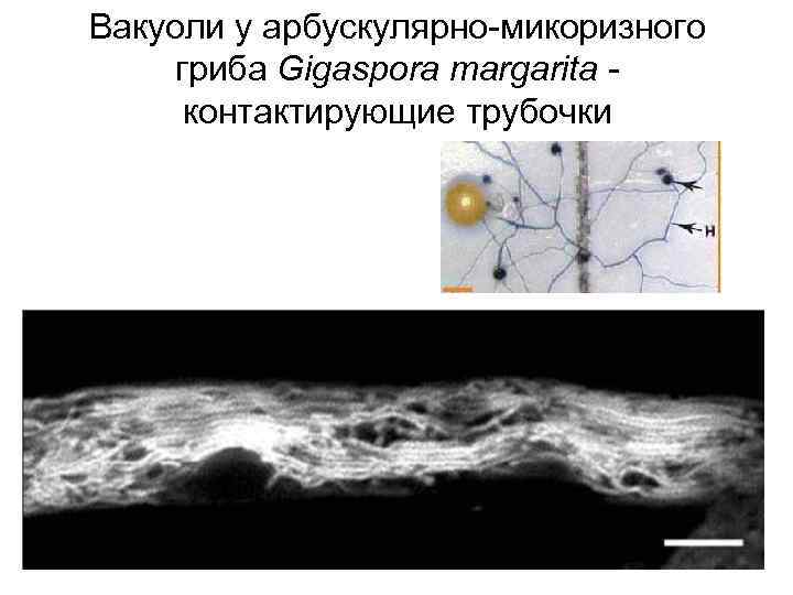 Вакуоли у арбускулярно-микоризного гриба Gigaspora margarita контактирующие трубочки 