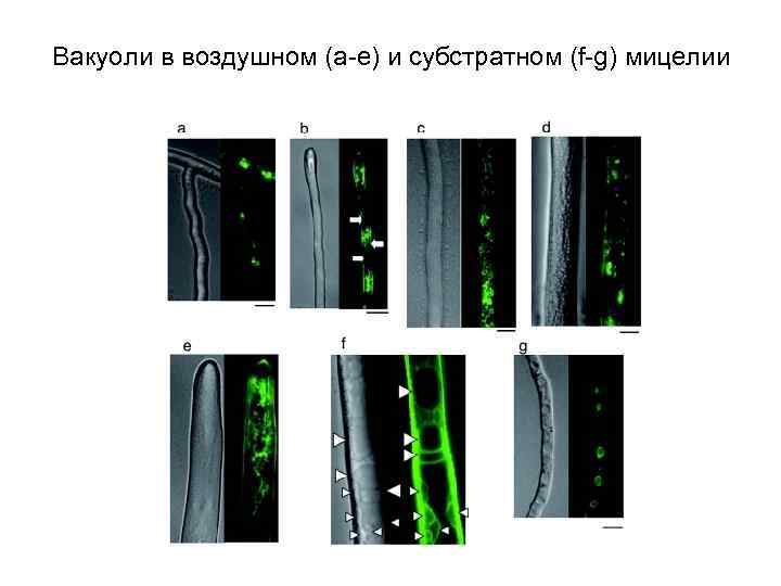 Вакуоли в воздушном (а-е) и субстратном (f-g) мицелии 