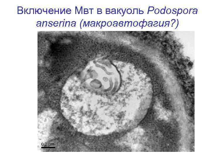 Включение Мвт в вакуоль Podospora anserina (макроавтофагия? ) 