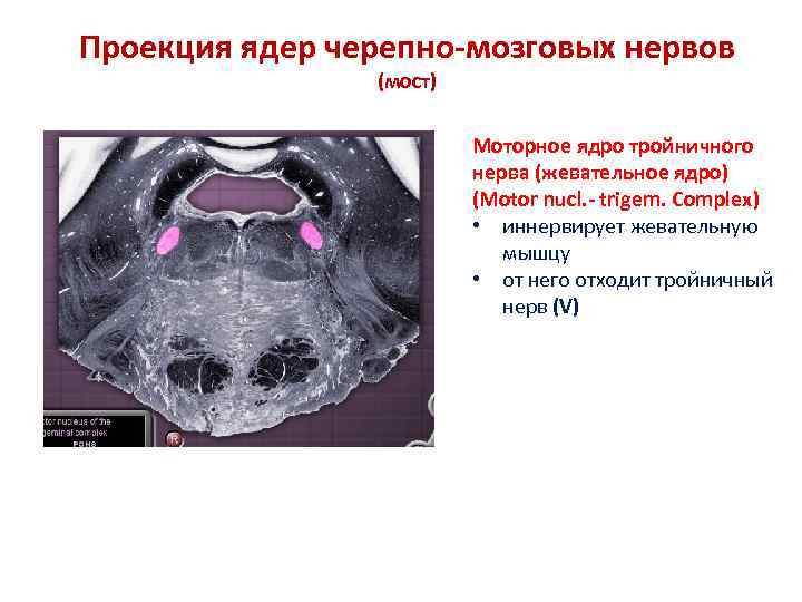 Проекция ядер черепно-мозговых нервов (мост) Моторное ядро тройничного нерва (жевательное ядро) (Motor nucl. -