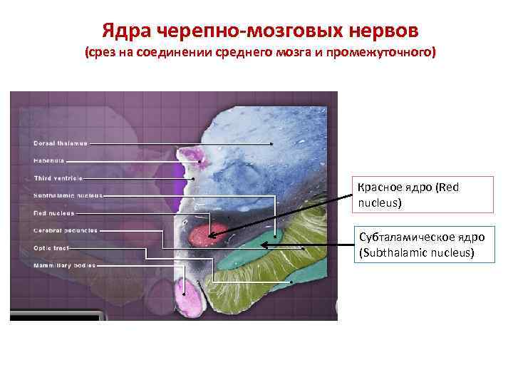 Ядра черепно-мозговых нервов (срез на соединении среднего мозга и промежуточного) Красное ядро (Red nucleus)