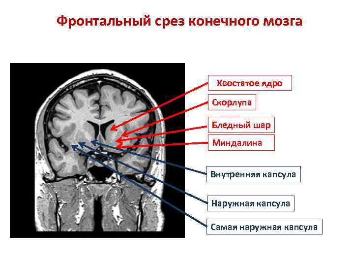 Фронтальный срез конечного мозга Хвостатое ядро Скорлупа Бледный шар Миндалина Внутренняя капсула Наружная капсула