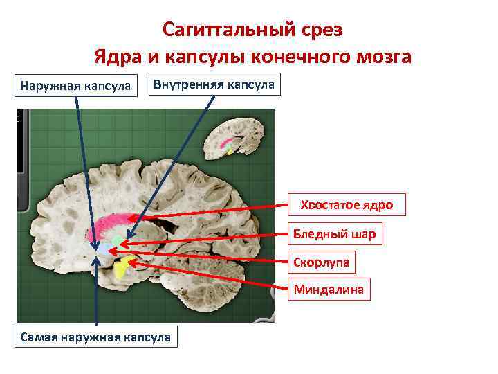 Сагиттальный срез Ядра и капсулы конечного мозга Наружная капсула Внутренняя капсула Хвостатое ядро Бледный