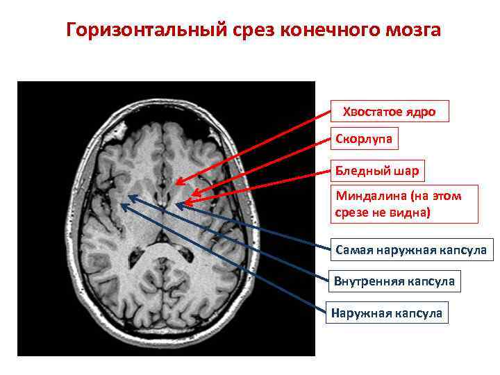 Горизонтальный срез конечного мозга Хвостатое ядро Скорлупа Бледный шар Миндалина (на этом срезе не