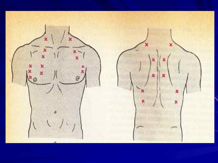 Аускультация легких. Аускультация грудной клетки пропедевтика. Точки аускультации грудной клетки. Сравнительная аускультация легких точки выслушивания. Точки сравнительной аускультации легких.