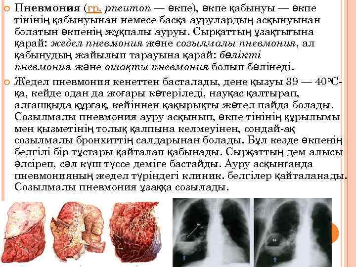  Пневмония (гр. pneumon — өкпе), өкпе қабынуы — өкпе тінінің қабынуынан немесе басқа