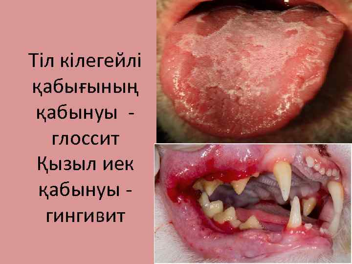 Тіл кілегейлі қабығының қабынуы глоссит Қызыл иек қабынуы гингивит 