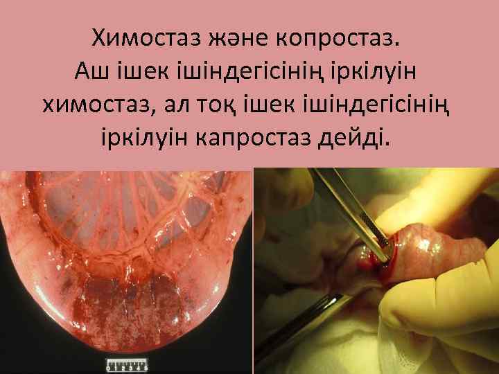 Химостаз және копростаз. Аш ішек ішіндегісінің іркілуін химостаз, ал тоқ ішек ішіндегісінің іркілуін капростаз