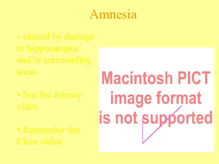 Amnesia caused by damage to hippocampus and/or surrounding areas • • See the Jeremy