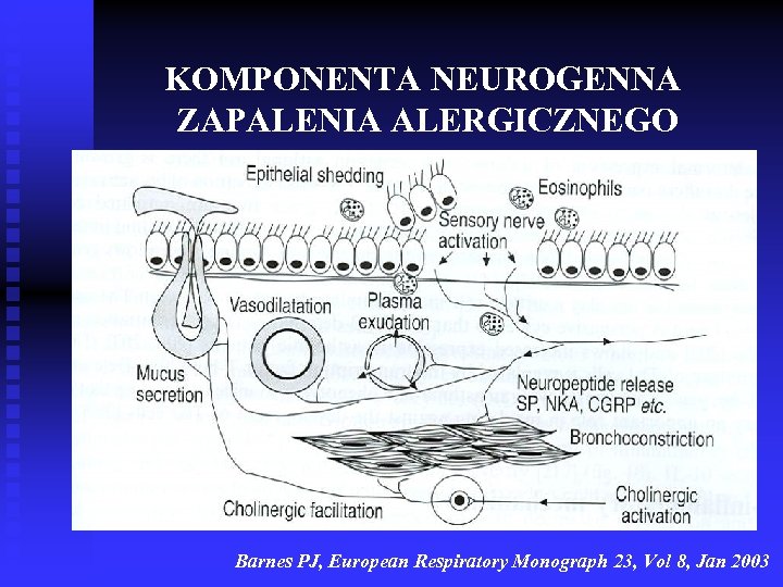 KOMPONENTA NEUROGENNA ZAPALENIA ALERGICZNEGO Barnes PJ, European Respiratory Monograph 23, Vol 8, Jan 2003