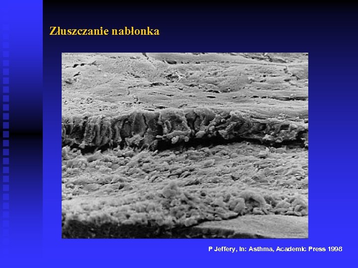 Złuszczanie nabłonka P Jeffery, in: Asthma, Academic Press 1998 