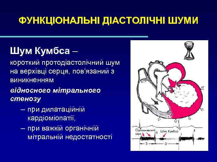 ФУНКЦІОНАЛЬНІ ДІАСТОЛІЧНІ ШУМИ Шум Кумбса – короткий протодіастолічний шум на верхівці серця, пов’язаний з