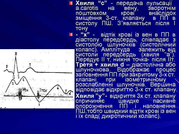 Хвиля “с” - передача пульсації a. carotis на вену, зворотнім поштовхом крові внаслідок зміщення