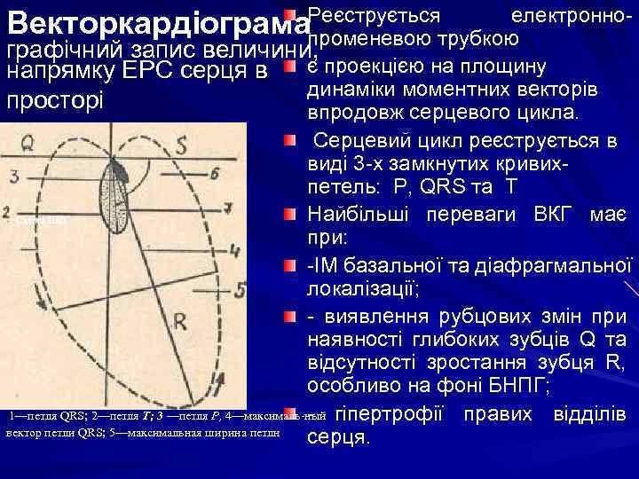 електронно. Векторкардіограма. Реєструється кою променевою труб графічний запис величини, напрямку ЕРС серця в є
