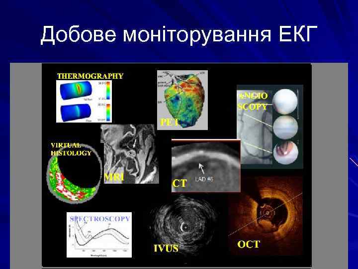 Добове моніторування ЕКГ 
