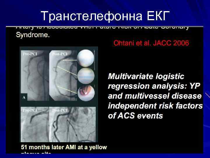 Транстелефонна ЕКГ 