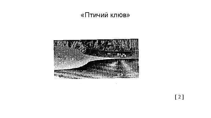  «Птичий клюв» [ 2 ] 