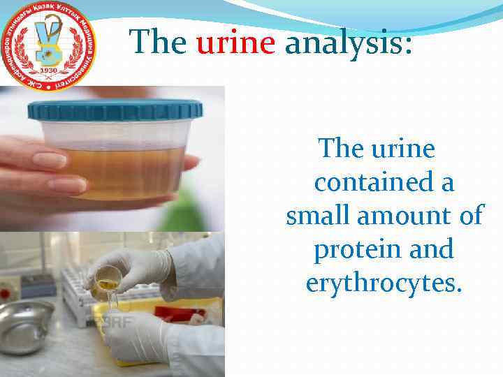The urine analysis: The urine contained a small amount of protein and erythrocytes. 