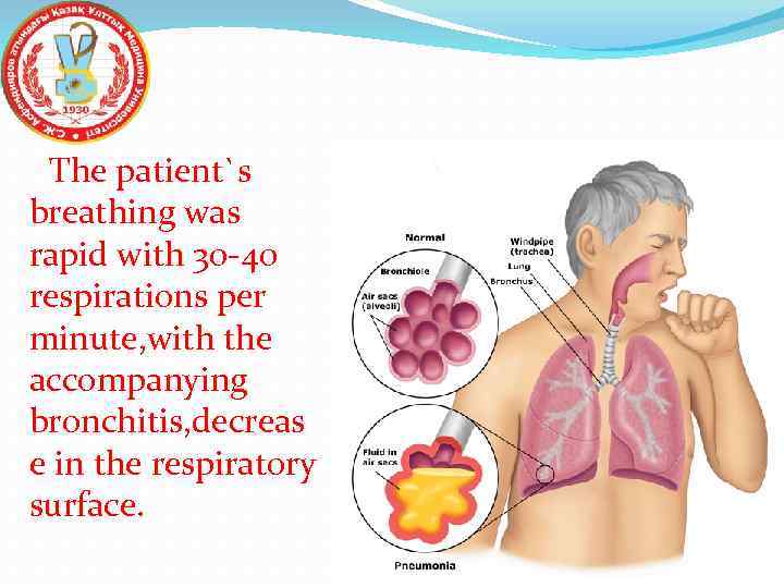 The patient`s breathing was rapid with 30 -40 respirations per minute, with the accompanying