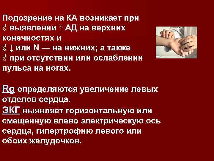 Подозрение на КА возникает при G выявлении ↑ АД на верхних конечностях и G