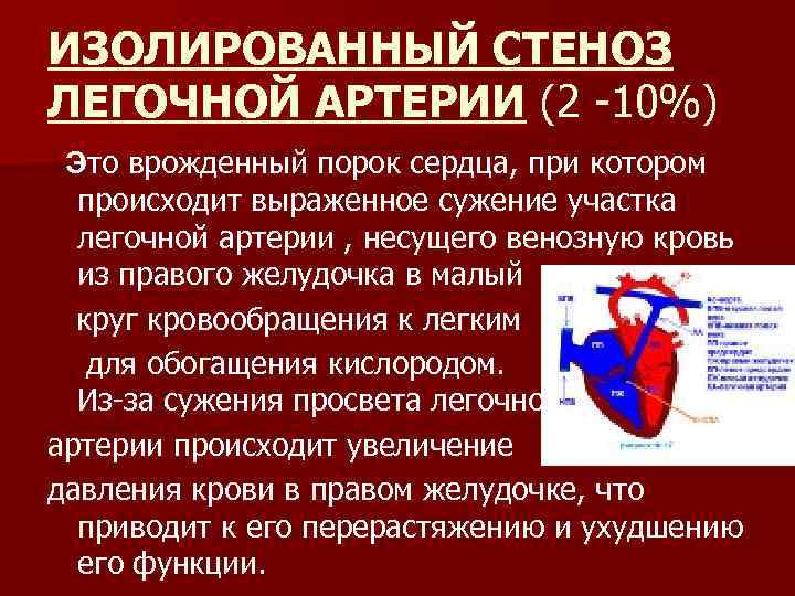 ИЗОЛИРОВАННЫЙ СТЕНОЗ ЛЕГОЧНОЙ АРТЕРИИ (2 -10%) Это врожденный порок сердца, при котором происходит выраженное