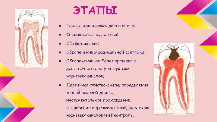 ЭТАПЫ ● Точная клиническая диагностика; ● Специальная подготовка; ● Обезболивание; ● Обеспечение максимальной асептики;