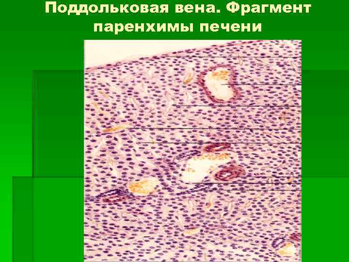 Поддольковая вена. Фрагмент паренхимы печени 