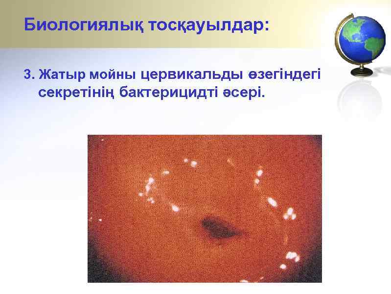 Биологиялық тосқауылдар: 3. Жатыр мойны цервикальды өзегіндегі секретінің бактерицидті әсері. 