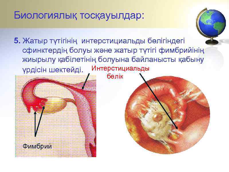 Биологиялық тосқауылдар: 5. Жатыр түтігінің интерстициальды бөлігіндегі сфинктердің болуы және жатыр түтігі фимбрийінің жиырылу