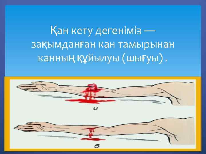 Қан кету дегеніміз — зақымданған кан тамырынан канның құйылуы (шығуы). 