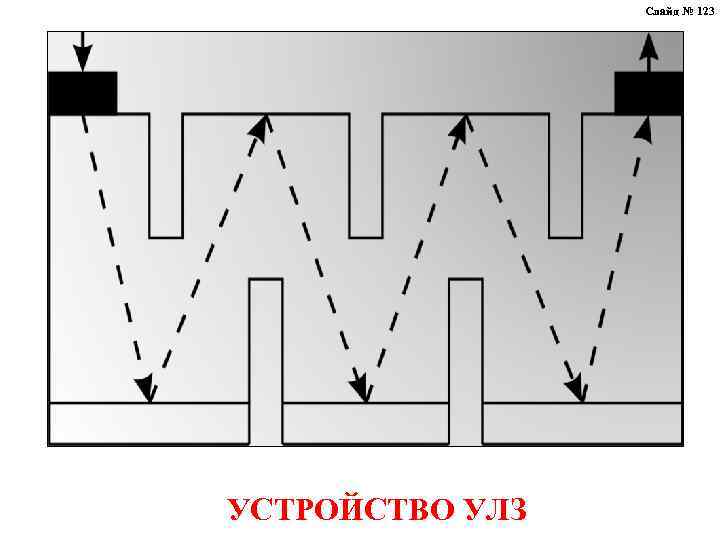 Слайд № 123 УСТРОЙСТВО УЛЗ 