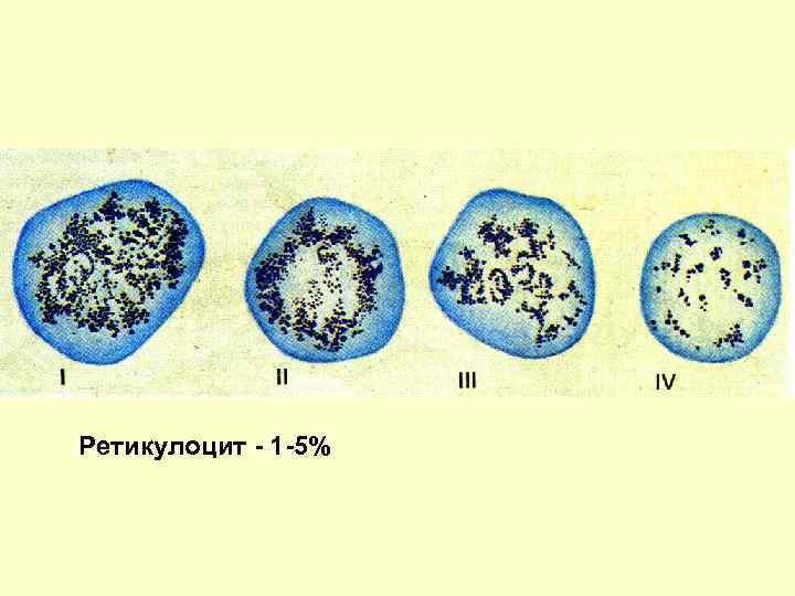 Ретикулоциты в мазке фото