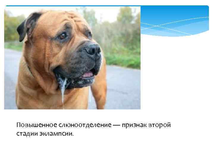 Повышенное слюноотделение — признак второй стадии эклампсии. 