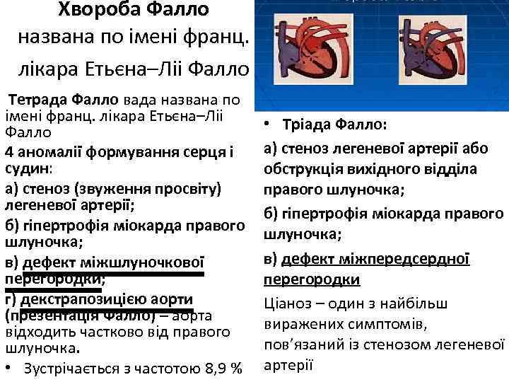 Хвороба Фалло названа по імені франц. лікара Етьєна–Ліі Фалло Тетрада Фалло вада названа по