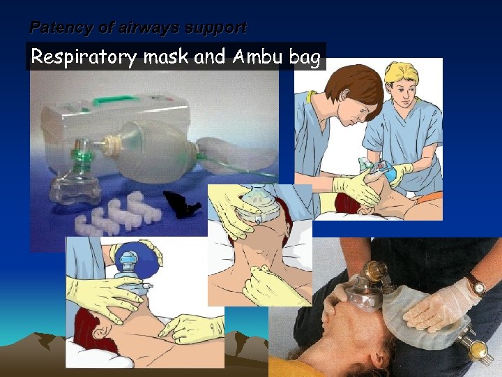 Patency of airways support Respiratory mask and Ambu bag 