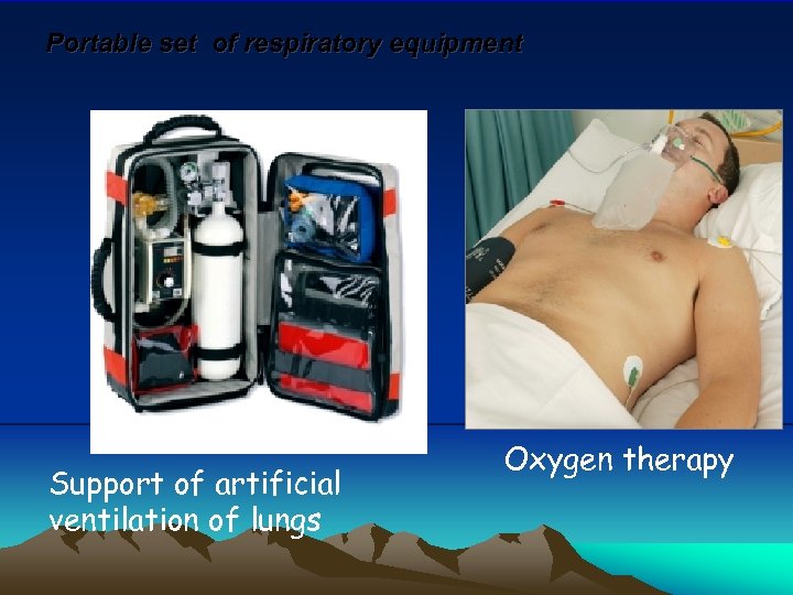 Portable set of respiratory equipment Support of artificial ventilation of lungs Oxygen therapy 