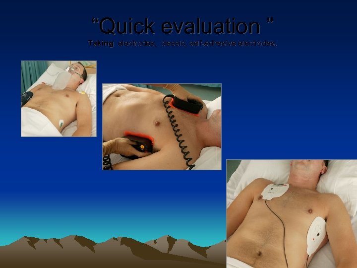 “Quick evaluation ” Taking electrodes, classic, self-adhesive electrodes. 