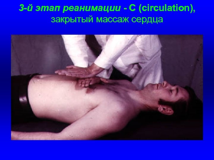 3 -й этап реанимации - С (circulation), закрытый массаж сердца 