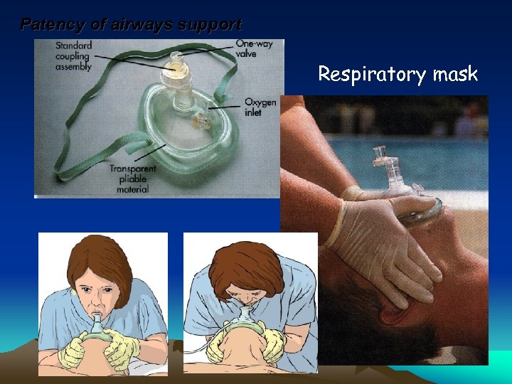 Patency of airways support Respiratory mask 