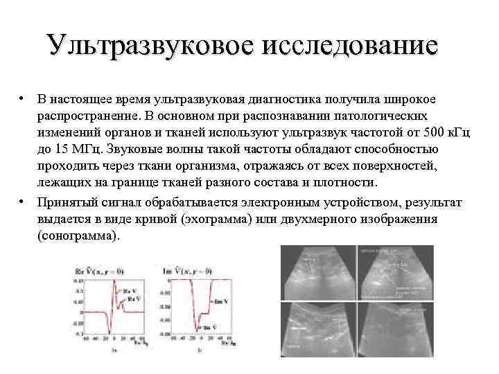 Ультразвуковое исследование • В настоящее время ультразвуковая диагностика получила широкое распространение. В основном при