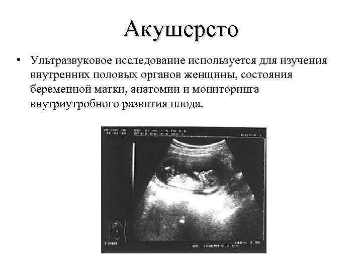 Акушерсто • Ультразвуковое исследование используется для изучения внутренних половых органов женщины, состояния беременной матки,
