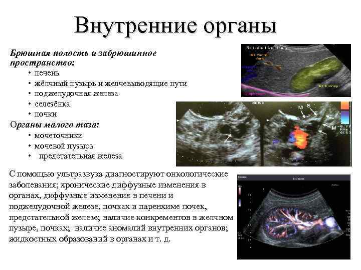 Внутренние органы Брюшная полость и забрюшинное пространство: • • • печень жёлчный пузырь и