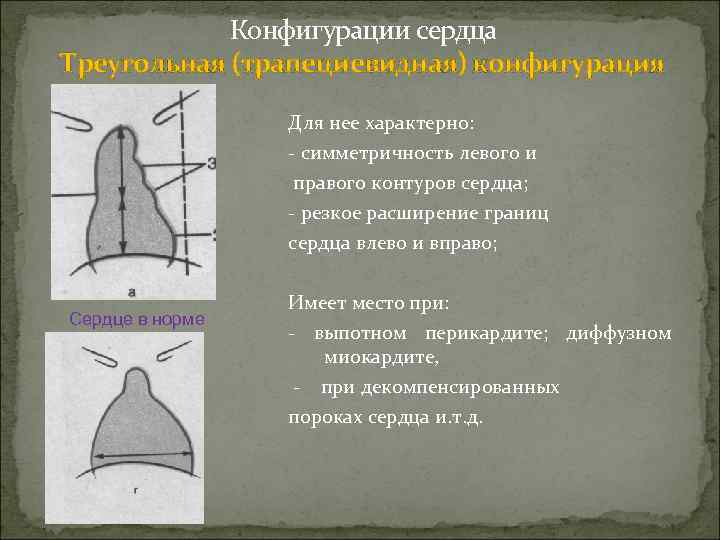 При выпотном перикардите на рентгенограмме наблюдается легочный рисунок тест ответ