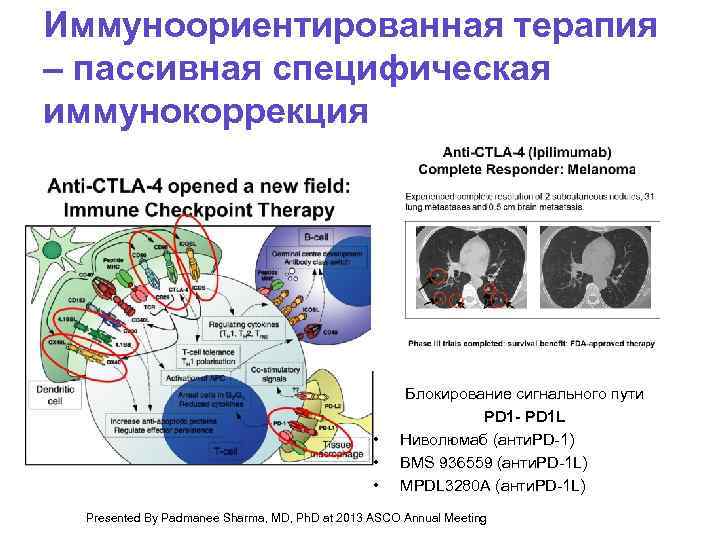 Иммуноориентированная терапия – пассивная специфическая иммунокоррекция • Блокирование сигнального пути PD 1 - PD